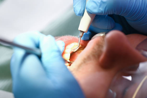 Best Emergency Tooth Extraction in St Joseph, MI